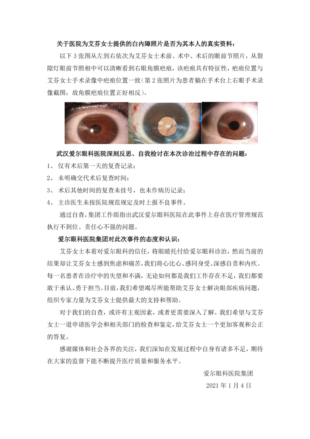 眼科病例分享：眼眶骨折导致大度数内斜视的手术矫正-天使文苑-甘肃省第二人民医院|西北民族大学附属医院