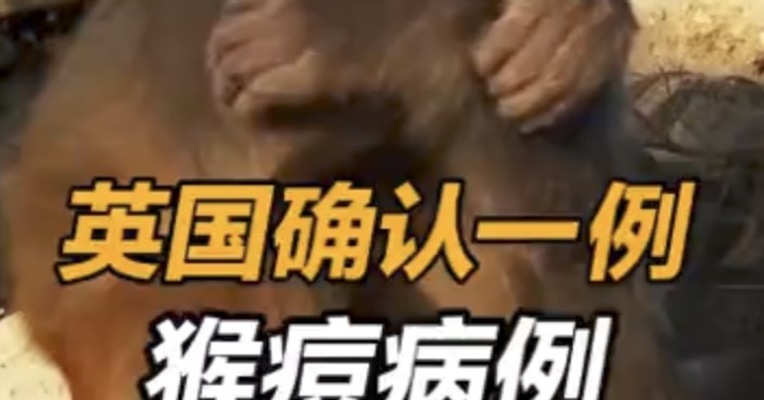 英国确认1例猴痘病例