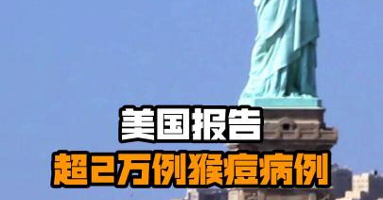 美国报告超2万例猴痘病例