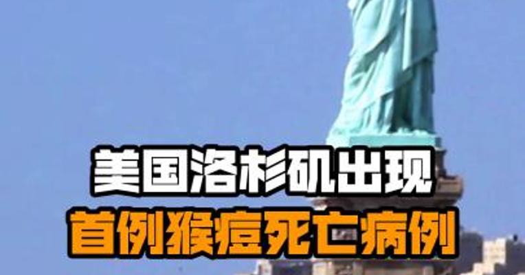 美国洛杉矶出现首例猴痘死亡病例