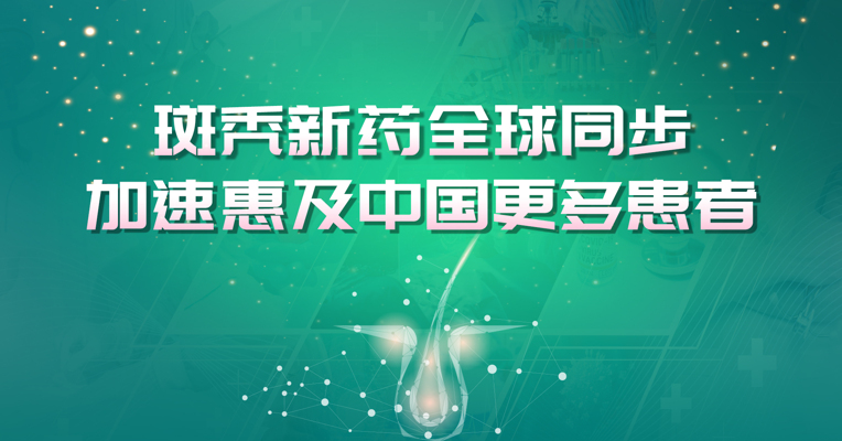 被称作“鬼剃头”的斑秃迎来新选择 首款创新药落地广州