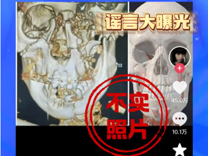邯郸初中生遇害案，网传颅骨照片不实！