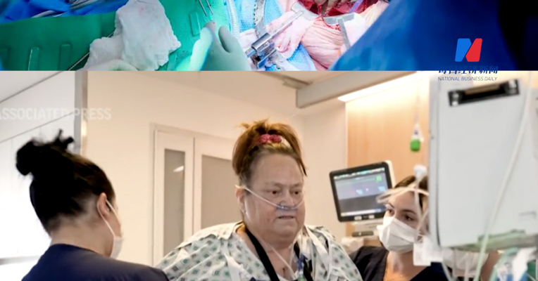 异种移植取得新进展！首例心脏泵和猪肾移植联合手术完成，54岁女病人术前仅有几周生命，术后，其丈夫：重新看到了妻子的笑容