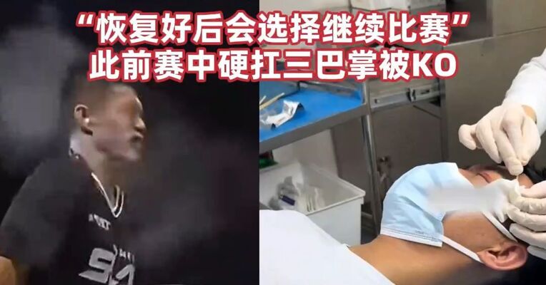 “世界扇耳光大赛”选手赵鸿刚回应近况：眼睛需花时间对焦，乍看有重影，“恢复好后会选择继续比赛”；此前赛中硬扛三巴掌被KO