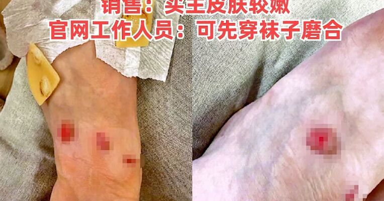女子买9250元LV运动鞋，穿上走了10分钟就多处严重破皮，要求退货被拒？销售：买主皮肤较嫩，官网工作人员：可先穿袜子磨合