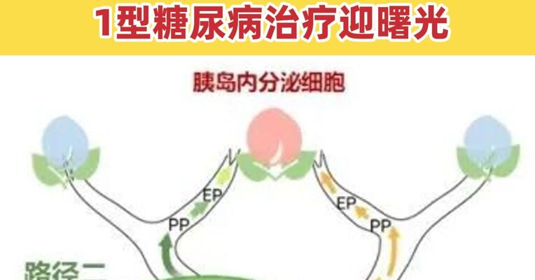治疗糖尿病我国科学家取得新突破！ 干细胞“智造”胰岛！1型糖尿病治疗迎曙光