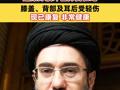 伊朗官员：最高领袖返回住所时遭爆炸波冲击摔倒在地，膝盖、背部及耳后受轻伤，现已康复，非常健康
