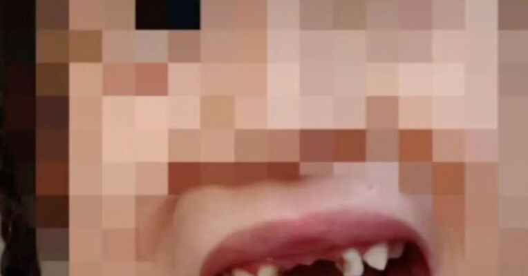 机器人踢掉5岁女童4颗牙，事发9个月赔偿仍未谈拢；家属：索赔15万元；科技馆：缺少确定的医疗结论，需第三方评估