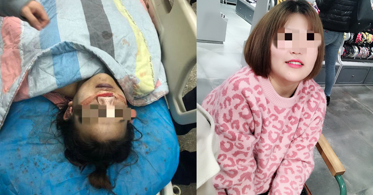 视频丨贵州19岁女生隆鼻术死亡当地卫生部门已介入调查   亲属：手术费26900元  