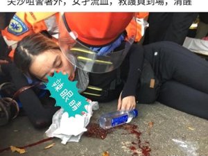 香港示威女子被“猪队友”击中眼睛 视力或严重受损（图）