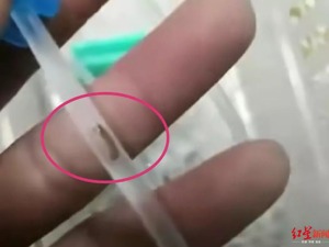 乐山3岁幼儿输液5分钟，家长竟发现输液管中有虫？医院道歉了！