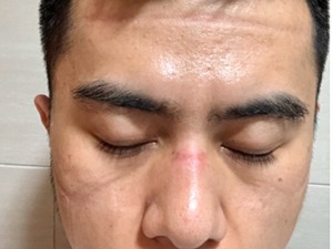 战地日记|张志博：穿上防护服，再难受也忍着