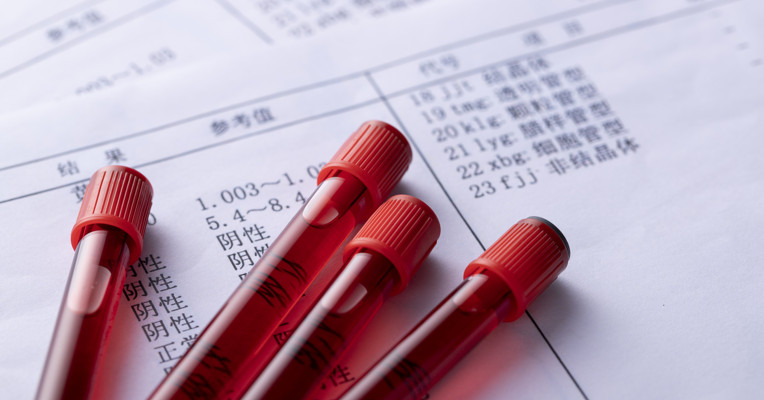 世卫组织：埃博拉疫情仍构成国际关注的突发公共卫生事件
