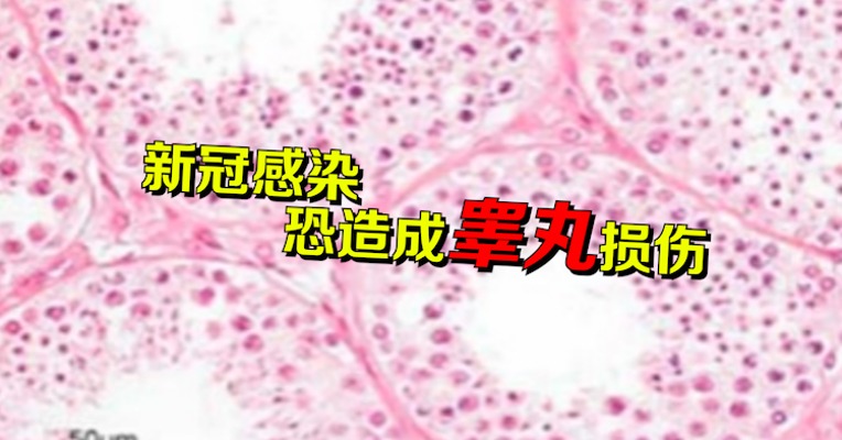 视频｜专家：新冠感染恐造成睾丸损伤 严重者可能导致不育