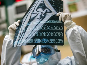 柳叶刀最新研究：意大利的实际感染规模可能比报告的数字多
