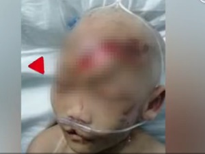 黑龙江省妇联密切关注“4岁女童疑被重伤”案：表示严厉的谴责，并提供法律援助