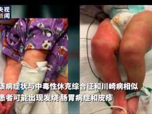 美国不明疾病致3名儿童死亡，或与新冠病毒相关，特朗普母亲节自夸防疫成绩“特棒”